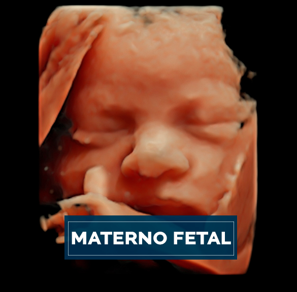 Conoce nuestras técnicas